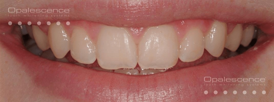 snapedit 1680893119047