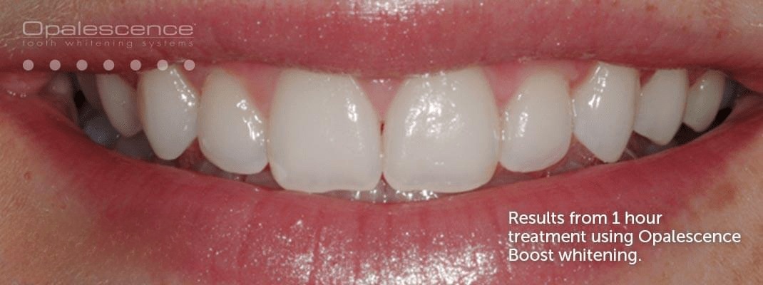 snapedit 1680893153632