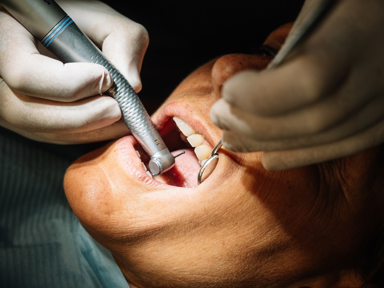 Dentist opens the mouth of his patient and begins to revise the interior helped by his instruments.